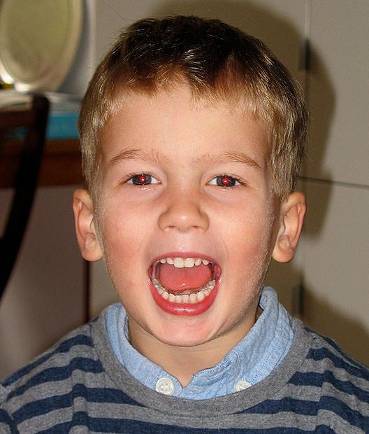 The red eye effect in a child's eyes